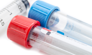 vials for urine testing